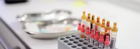 Blutproben beim Arzt oder im Labor - Blut abnehmen Blutproben beim Arzt oder im Labor - Blut abnehmen