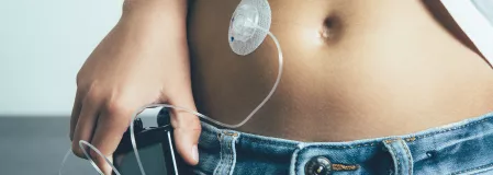 Kind mit Insulinpumpe Kind mit Insulinpumpe