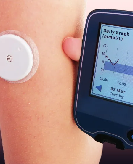 Ein Leseger&auml;t eines CGM wird neben einem Arm gehalten. Auf dem Arm klebt ein Sensor