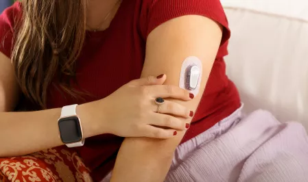 Sensor CGM Junge Frau trägt einen Sensor eines CGM-Systems am Arm