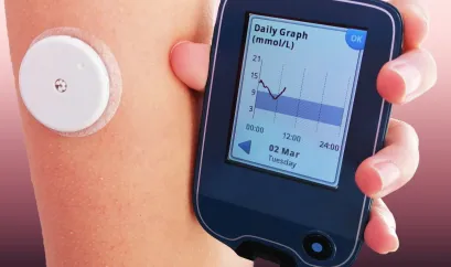 Ein Leseger&auml;t eines CGM wird neben einem Arm gehalten. Auf dem Arm klebt ein Sensor