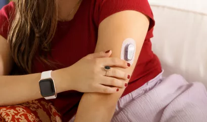 Junge Frau trägt einen Sensor eines CGM-Systems am Arm